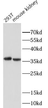 AKR1B10 Antibody