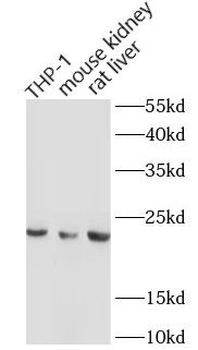 GPX1 Rabbit Polyclonal Antibody