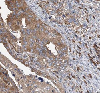 MSLN Rabbit Polyclonal Antibody