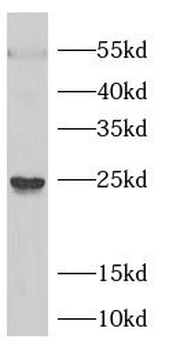 HBEGF Rabbit Polyclonal Antibody