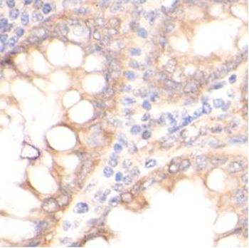 HBEGF Rabbit Polyclonal Antibody