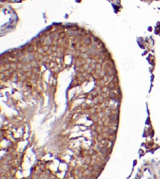 GPX4 Mouse Monoclonal Antibody