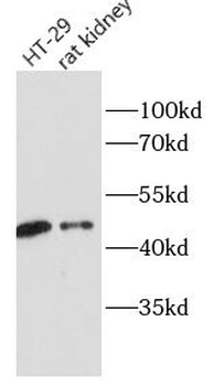 HOXA10 Rabbit Polyclonal Antibody