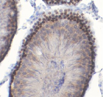 HOXA10 Rabbit Polyclonal Antibody