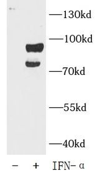 Phospho STAT3 Rabbit Polyclonal Antibody