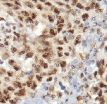 RAD50 Rabbit Polyclonal Antibody