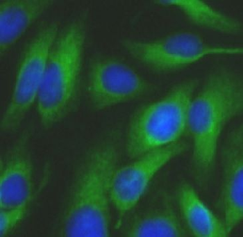 GSDMD Mouse Monoclonal Antibody