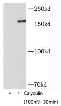 Phospho-PERK (Thr982) Rabbit Polyclonal Antibody