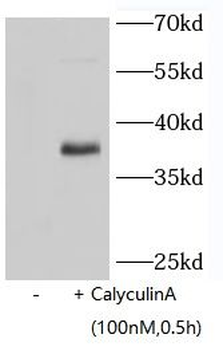 Phospho-EIF2S1 (Ser51) Mouse Monoclonal Antibody