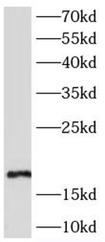 CST5 Rabbit Polyclonal Antibody