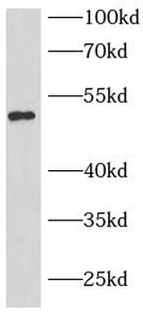 mCherry Rabbit Polyclonal Antibody
