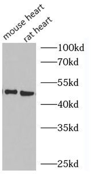GLUT4 Antibody