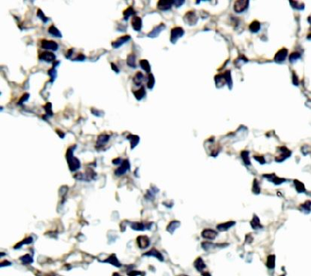 NCOA4 Rabbit Polyclonal Antibody
