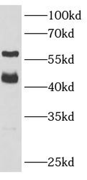 RBFOX2 Rabbit Polyclonal Antibody