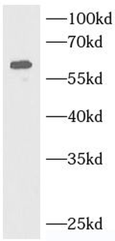 CALCR Rabbit Polyclonal Antibody