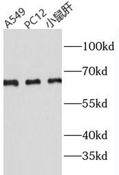 PHF-1 Rabbit Polyclonal Antibody