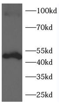 GSDMD-N Rabbit Polyclonal Antibody
