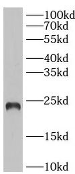 IL6 Antibody