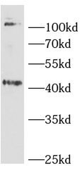 NEU2 Rabbit Polyclonal Antibody
