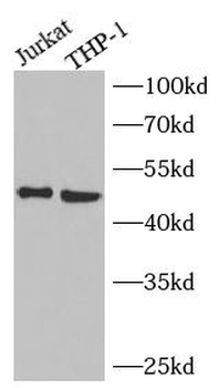 NEU3 Rabbit Polyclonal Antibody