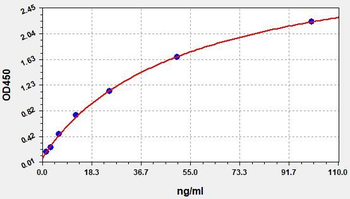 Human Anti-Ustekinumab antibody ELISA Kit
