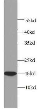 EIF4EBP1 Mouse Monoclonal Antibody