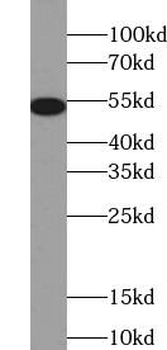 6*His, His-Tag Antibody