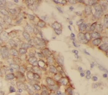 Acetylated tubulin (Lys40) Antibody