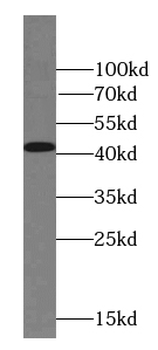 ACTA1 Specific Rabbit Polyclonal Antibody