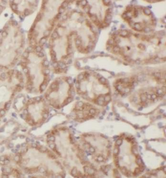 PLIN2 Mouse Monoclonal Antibody