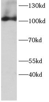 AVIL Rabbit Polyclonal Antibody