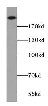 AFDN Rabbit Polyclonal Antibody