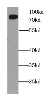 AMPD1 Antibody