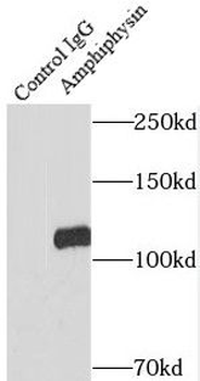 AMPH Rabbit Polyclonal Antibody