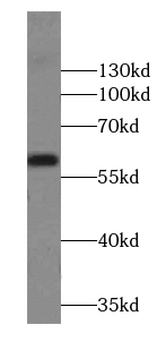 AMY2B Rabbit Polyclonal Antibody