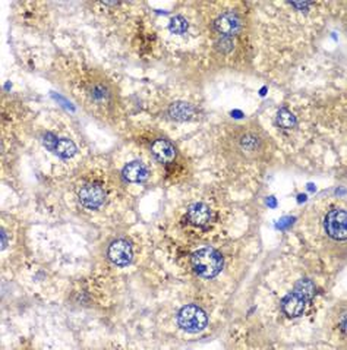 AMY2A Rabbit Polyclonal Antibody