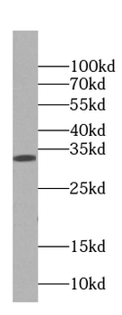 ANXA4 Mouse Monoclonal Antibody