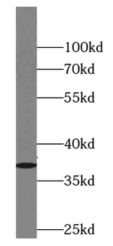 ANXA8 Rabbit Polyclonal Antibody
