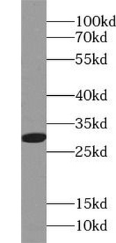ANP32B Antibody