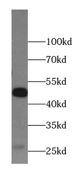 AZIN1 Rabbit Polyclonal Antibody