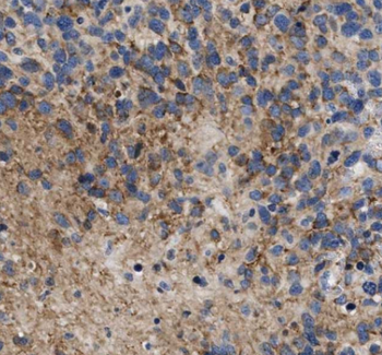AZIN1 Rabbit Polyclonal Antibody