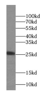 NAA11 Rabbit Polyclonal Antibody