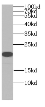 ARF5 Specific Rabbit Polyclonal Antibody