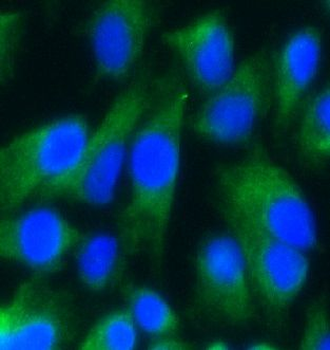 ATP5F1A Mouse Monoclonal Antibody