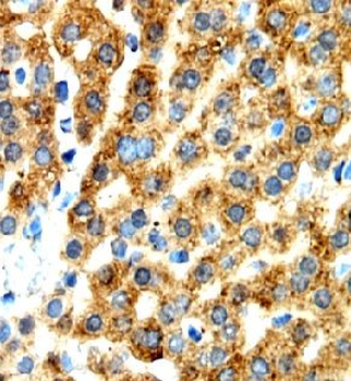 ATP5F1A Mouse Monoclonal Antibody