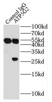 ATP5MC2 Specific Rabbit Polyclonal Antibody