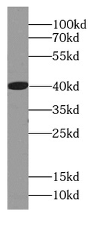 AZGP1 Mouse Monoclonal Antibody