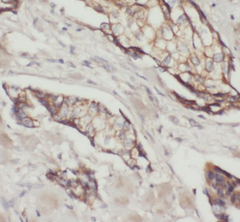 AZGP1 Mouse Monoclonal Antibody