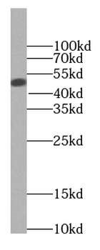 BCS1L Mouse Monoclonal Antibody