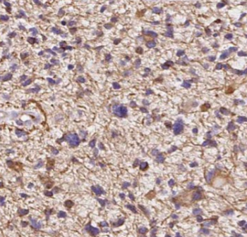 BCS1L Mouse Monoclonal Antibody